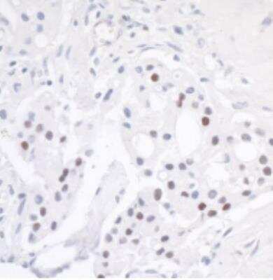 Immunohistochemistry-Paraffin: KAP1 [p Ser824] Antibody [NB100-2350]